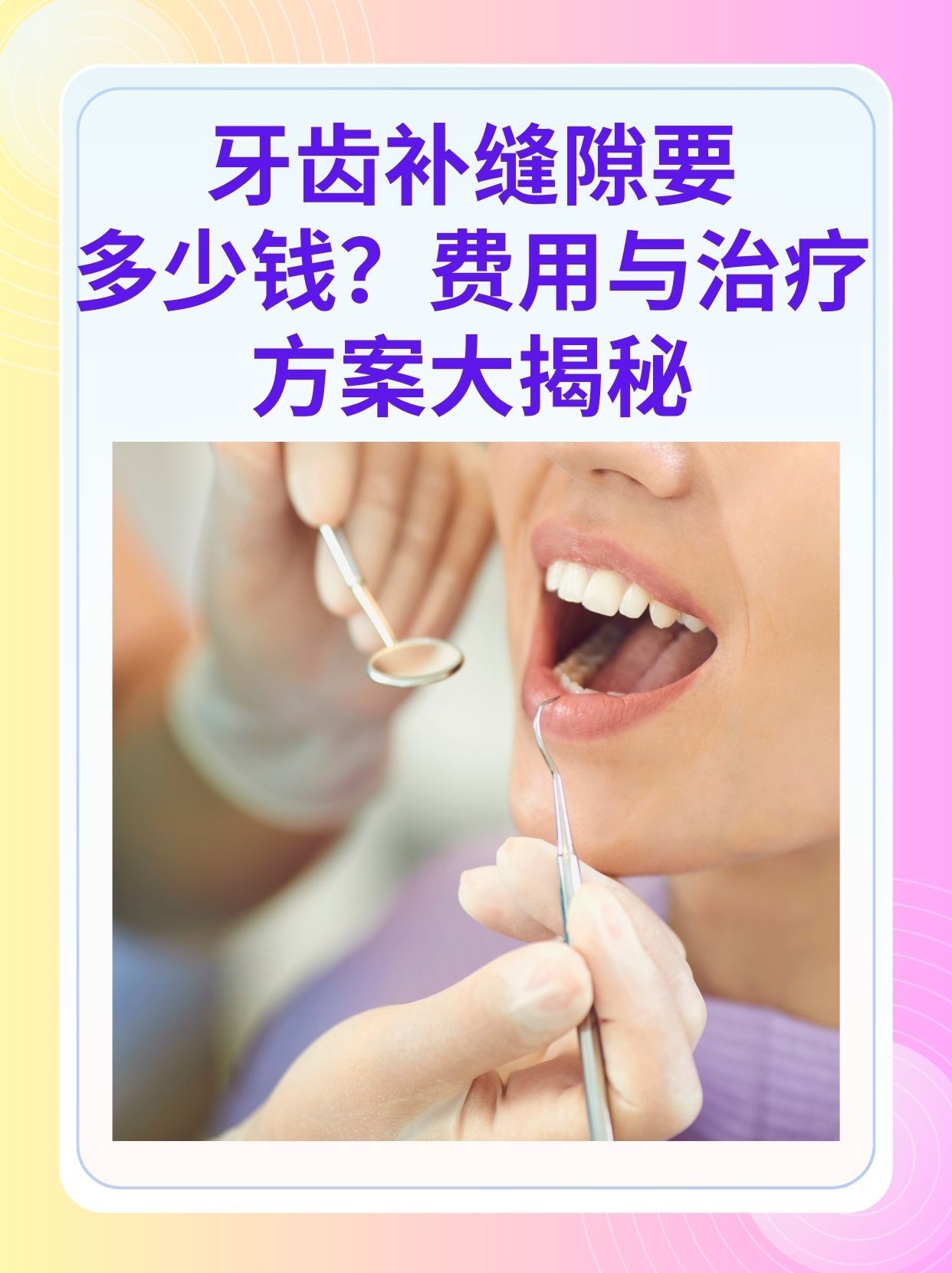 滨州补牙医保可以报销吗(补牙医保可以报销吗 哪些可以报销呢)